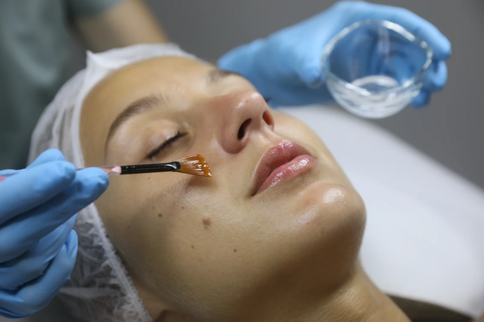 a person applying Chemical Peels