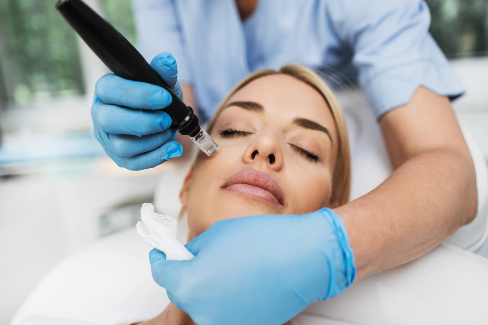a woman getting a Microneedling