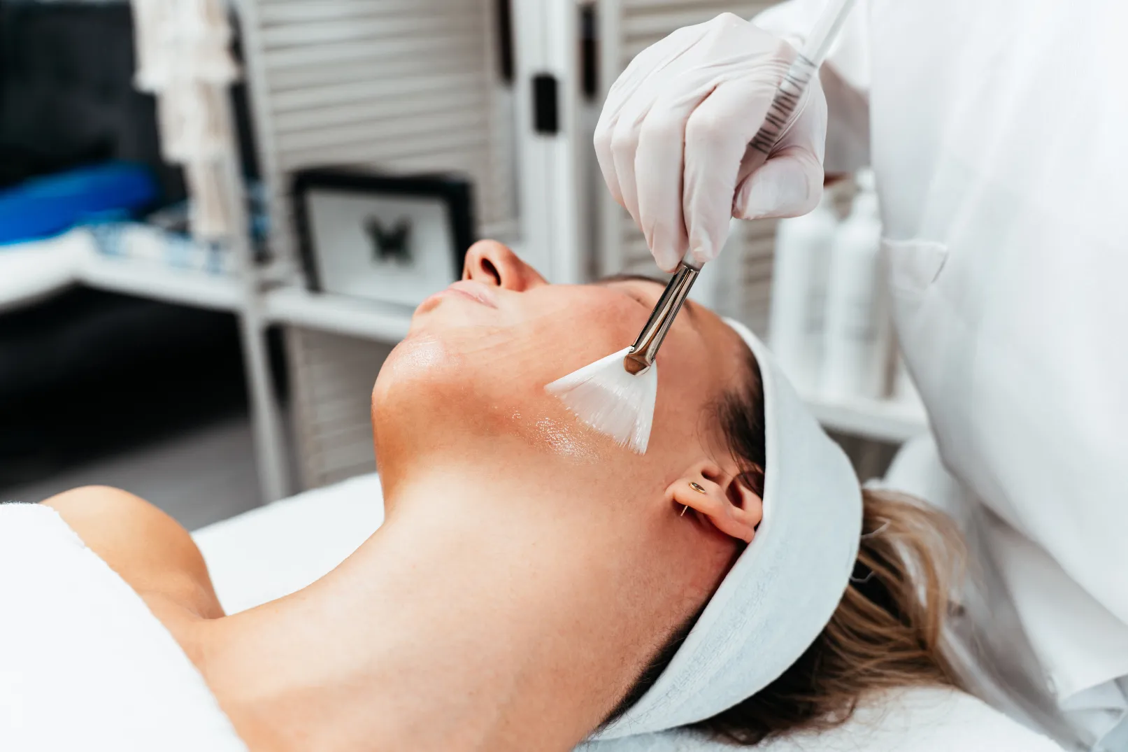 Chemical Peels in Roswell, GA for Smoother, Brighter, Even-Toned Skin